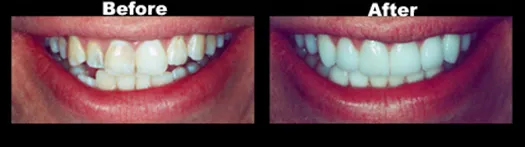 Case_1